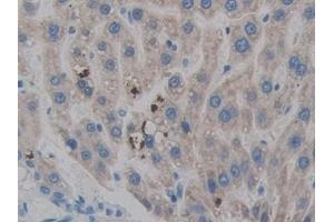 Detection of HPSE in Rat Liver Tissue using Polyclonal Antibody to Heparanase (HPSE) (HPSE Antikörper  (AA 40-188))