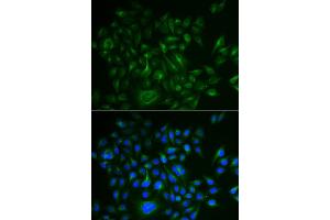 Immunofluorescence analysis of HeLa cell using BAMBI antibody. (BAMBI Antikörper)