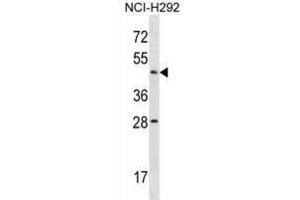 Western Blotting (WB) image for anti-Actin-Like 7b (Actl7b) antibody (ABIN2998793) (Actl7b Antikörper)