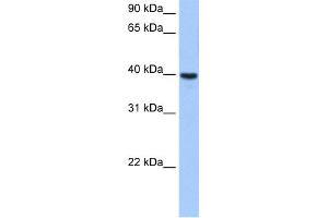 WB Suggested Anti-ST6GALNAC4 Antibody Titration:  0. (ST6GALNAC4 Antikörper  (Middle Region))