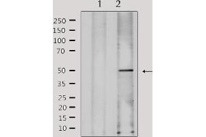 Western blot analysis of extracts from Hela, using FKRP Antibody. (FKRP Antikörper  (N-Term))