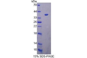 SDS-PAGE analysis of Human ACAT1 Protein. (ACAT1 Protein)