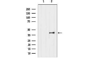 anti-Sphingosine-1-Phosphate Receptor 3 (S1PR3) (N-Term) antibody