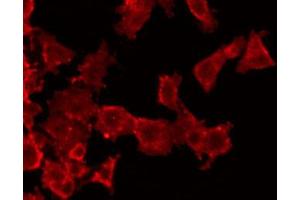 ABIN6272532 staining HuvEc by IF/ICC. (HNF1B Antikörper  (Internal Region))