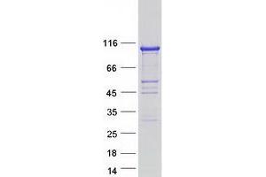 Western Blotting (WB) image for Inositol-Trisphosphate 3-Kinase C (ITPKC) protein (Myc-DYKDDDDK Tag) (ABIN2723768)