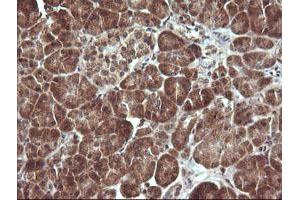 Image no. 1 for anti-Mitogen-Activated Protein Kinase Kinase 3 (MAP2K3) antibody (ABIN1499409)