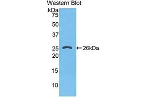 Western blot analysis of the recombinant protein. (FKBP8 Antikörper  (AA 110-329))