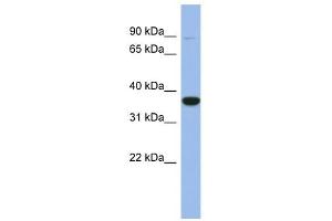 FANCL antibody used at 1 ug/ml to detect target protein. (FANCL Antikörper  (Middle Region))