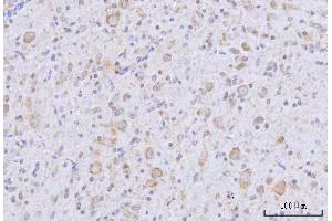 IHC analysis of RARS/RARS1 using anti-RARS/RARS1 antibody (ABIN7600223). (Probable Arginine--tRNA Ligase, Cytoplasmic (RARS-1) (AA 165-425) Antikörper)