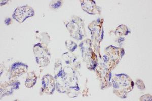 Anti-Galectin 3 Picoband antibody,  IHC(P): Human Placenta Tissue (Galectin 3 Antikörper  (AA 139-250))