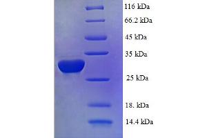 SDS-PAGE (SDS) image for Inhibitor of DNA Binding 2 (Id2) (AA 1-134), (full length) protein (His-SUMO Tag) (ABIN5709695) (Id2 Protein (AA 1-134, full length) (His-SUMO Tag))
