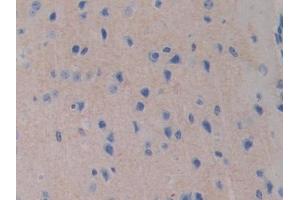 IHC-P analysis of Mouse Cerebrum Tissue, with DAB staining. (FDFT1 Antikörper  (AA 217-416))