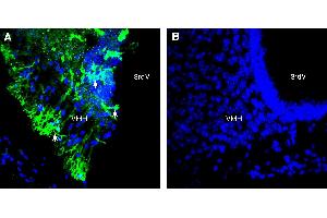 Expression of SCN7A in mouse ventromedial hypothalamus (VMH).