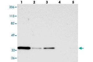 Western blot analysis of Lane 1: RT-4, Lane 2: U-251 MG, Lane 3: A-431, Lane 4: Liver, Lane 5: Tonsil with STX3 polyclonal antibody  at 1:250-1:500 dilution. (STX3 Antikörper)