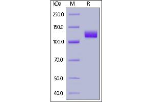 Human PSMA, Fc Tag on  under reducing (R) condition. (PSMA Protein (AA 44-750) (Fc Tag))