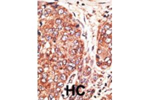Immunohistochemistry (IHC) image for anti-Septin 9 (SEPT9) antibody (ABIN3002552) (Septin 9 Antikörper)