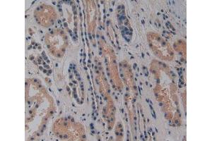 Used in DAB staining on fromalin fixed paraffin-embedded Heart tissue (NOSIP Antikörper  (AA 62-295))