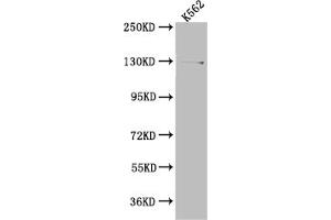 Western Blot Positive WB detected in: K562 whole cell lysate All lanes: HAUSP antibody at 1:1000 Secondary Goat polyclonal to rabbit IgG at 1/50000 dilution Predicted band size: 129, 127 kDa Observed band size: 140 kDa (Rekombinanter USP7 Antikörper)