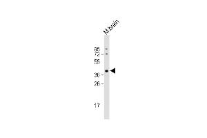 Western Blotting (WB) image for anti-ELAV (Embryonic Lethal, Abnormal Vision, Drosophila)-Like 2 (Hu Antigen B) (ELAVL2) (AA 156-184) antibody (ABIN656861)