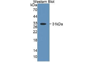 Western Blotting (WB) image for anti-ATP-Binding Cassette, Sub-Family D (Ald), Member 4 (ABCD4) (AA 356-606) antibody (ABIN5013197)