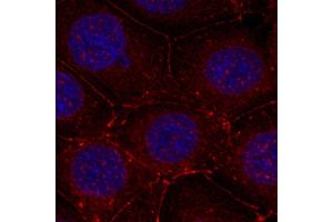 Immunofluorescence staining of methanol-fixed MCF-7 cells using Phospho-IGF1R-Y1161 antibody (ABIN2988064). (IGF1R Antikörper  (pTyr1161))