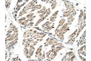 SLC6A8 antibody was used for immunohistochemistry at a concentration of 4-8 ug/ml to stain Skeletal muscle cells (arrows) in Human Muscle.