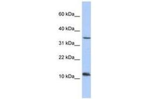 Image no. 1 for anti-Nucleoredoxin-Like 2 (NXNL2) (AA 71-101) antibody (ABIN6743672) (NXNL2 Antikörper  (AA 71-101))