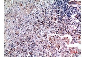 Immunohistochemistry (IHC) analysis of paraffin-embedded Human Lung, antibody was diluted at 1:100. (IL-6 Antikörper  (Internal Region))