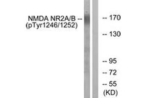 Western Blotting (WB) image for anti-Glutamate Receptor, Ionotropic, N-Methyl D-Aspartate 2A/B (GRIN2A/B) (AA 1216-1265), (pTyr1246) antibody (ABIN482229) (NMDAR2A + 2B Antikörper  (pTyr1246))