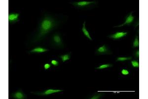 Immunofluorescence of monoclonal antibody to C1D on HeLa cell. (C1D Antikörper  (AA 1-141))