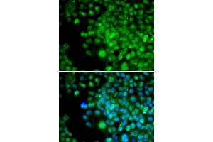 Immunofluorescence (IF) image for anti-Four and A Half LIM Domains 1 (FHL1) antibody (ABIN1876648) (FHL1 Antikörper)