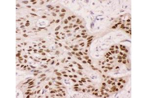 Immunohistochemistry (IHC) image for anti-T-Complex 1 (TCP1) (AA 311-680) antibody (ABIN3029088)