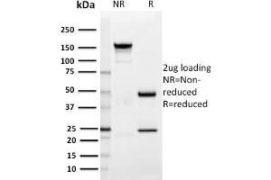 SDS-PAGE Analysis Purified SIGLEC1 / CD169 Mouse Monoclonal Antibody (HSn 7D2).