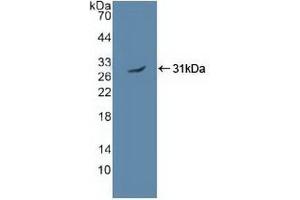 Detection of Recombinant PRKAa2, Human using Polyclonal Antibody to Protein Kinase, AMP Activated Alpha 2 (PRKAa2) (AMP Activated Protein Kinase Alpha2 (AA 252-493) Antikörper)