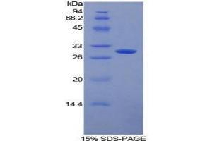 SDS-PAGE analysis of Human FcgRII Protein.