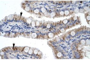 Human Intestine; Rabbit Anti-ZNF341 Antibody. (ZNF341 Antikörper  (Middle Region))