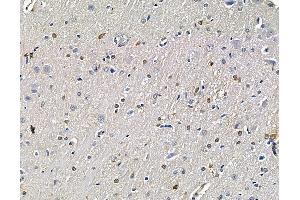 ABIN7096434 and ABIN7100498 at 1/100 staining rat brain tissue by IHC-P. (KLF3 Antikörper)