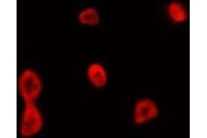 ABIN6275085 staining HepG2 by IF/ICC. (CCNB1IP1 Antikörper  (Internal Region))