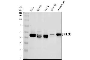 Western blot analysis of IKB beta using anti-IKB beta antibody (ABIN3043567).