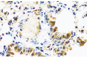Immunohistochemistry of paraffin-embedded Mouse lung using C8orf4 Polyclonal Antibody at dilution of 1:100 (40x lens). (C8orf4 Antikörper)