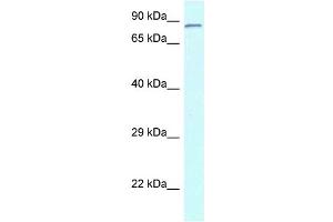 WB Suggested Anti-Cnot3 Antibody Titration: 1. (CNOT3 Antikörper  (N-Term))