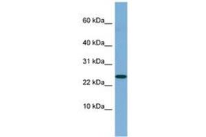 Image no. 1 for anti-Neuroblastoma 1, DAN Family BMP Antagonist (NBL1) (C-Term) antibody (ABIN6741850) (NBL1 Antikörper  (C-Term))