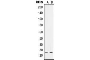 Western blot analysis of RIT1 expression in A549 (A), HeLa (B) whole cell lysates.