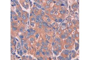 IHC-P analysis of Mouse Tissue, with DAB staining. (UCP1 Antikörper  (AA 179-296))