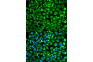 Immunofluorescence analysis of MCF-7 cells using SAT2 antibody. (SAT2 Antikörper)