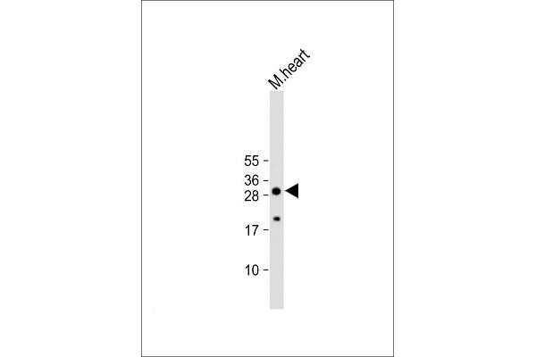 AQP11 Antikörper  (C-Term)