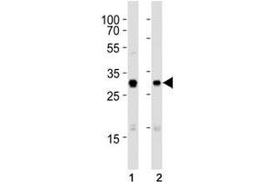 Western blot analysis of lysate from (1) A431 and (2) SK-BR-3 cell line using Cdk1 antibody at 1:1000.