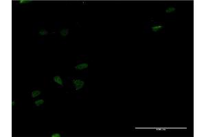Immunofluorescence of monoclonal antibody to LEF1 on HeLa cell. (LEF1 Antikörper  (AA 33-138))