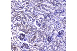 IHC analysis of VE Cadherin using anti-VE Cadherin antibody . (Cadherin 5 Antikörper  (AA 46-285))