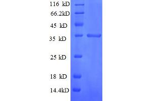 SDS-PAGE (SDS) image for Chemokine (C-X-C Motif) Ligand 10 (CXCL10) (AA 22-98) protein (GST tag) (ABIN5712672)